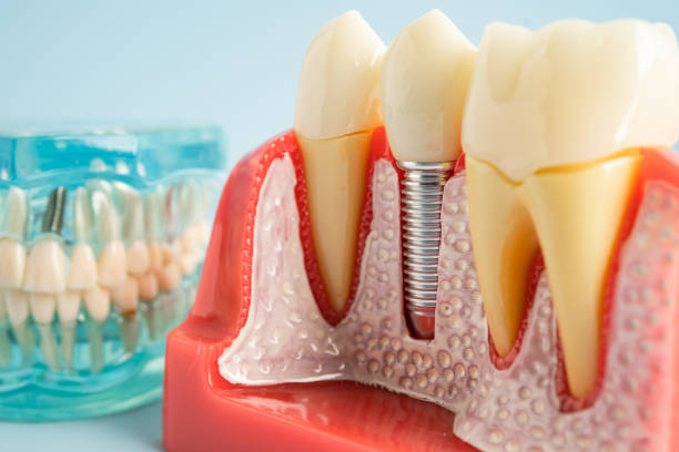 Professional  Dental Services in Falls City, OR